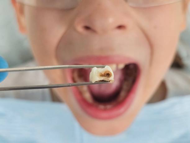 Best Emergency Care for Gum Disease in Cresco, IA